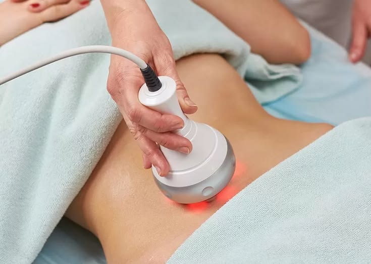 Tratamento Flacidez RF